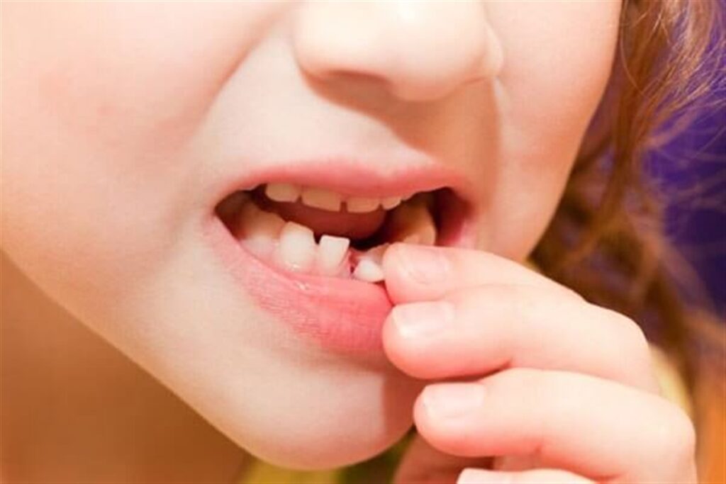 زمان افتادن دندان های شیری در کودکان