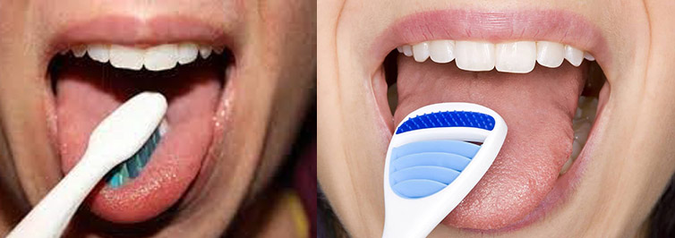 Brushing the tongue مسواک زدن زبان برای پیشگیری از بوی بد دهان