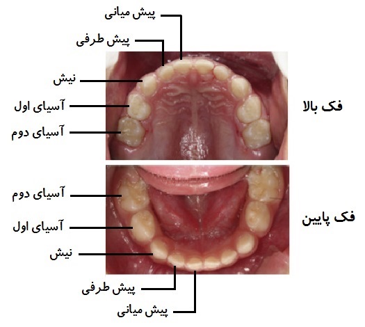 عکس دندان شیری کودکان به همراه نامگذاری دندان ها