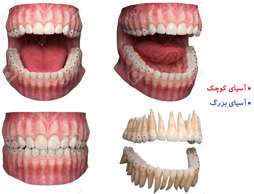 تصویر دندان آسیای بزرگ و آسیای کوچک 