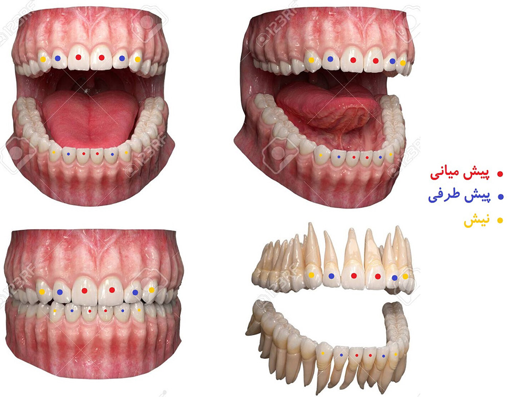 نگاهی به انواع دندان های دائمی روی تصویر دندان های طبیعی