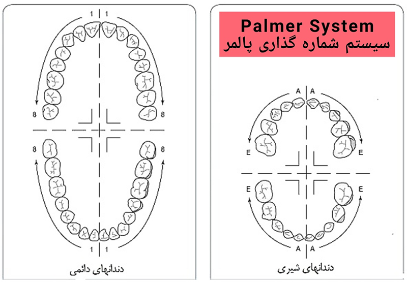 سیستم شماره گذاری پالمر دندانپزشکی - آموزش دستیار دندانپزشک
