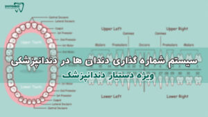 سیستم شماره گذاری دندان ها - سیستم شماره گذاری پالمر palmer numbering system دستیار دندانپزشک