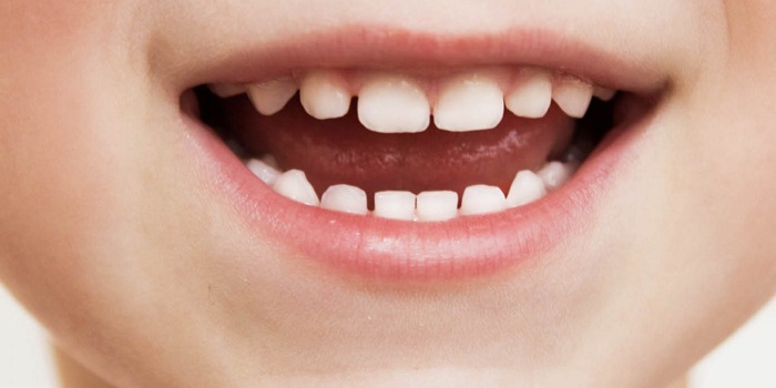 عکس دندان شیری انسان Deciduous /Primary teeth