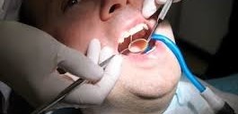 ساکشن معمولی وسایل دندانپزشکی آموزش