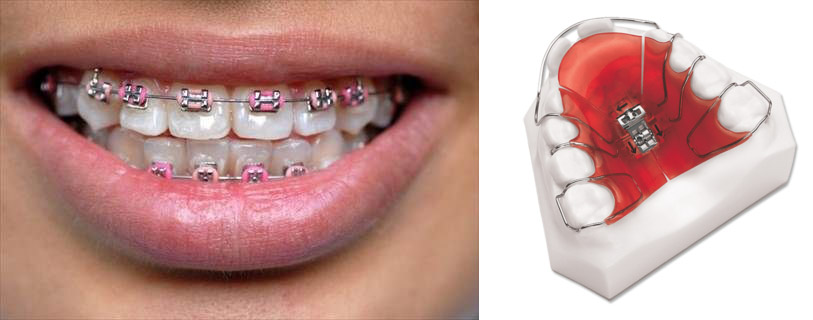 Orthodontics (تخصص ارتودنسی)