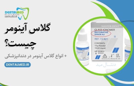 گلاس آینومر چیست Glass ionomer انواع گلاس آینومر در دندانپزشکی گلاس آینومر لوتینگ گلاس آینومر لایت کیور قیمت گلس دندانپزشکی گلاس آینومر ترمیمی سمان گلاس آینومر