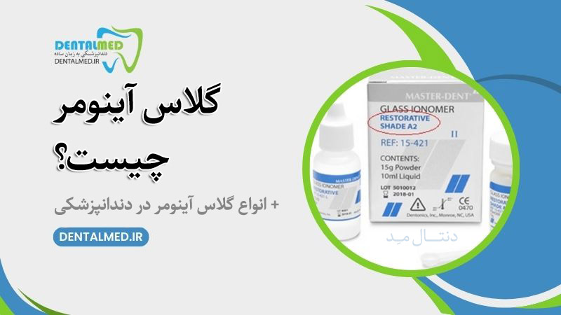 گلاس آینومر چیست Glass ionomer انواع گلاس آینومر در دندانپزشکی گلاس آینومر لوتینگ گلاس آینومر لایت کیور قیمت گلس دندانپزشکی گلاس آینومر ترمیمی سمان گلاس آینومر