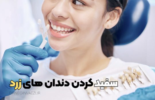 سفید کردن دندان ها زرد، بلیچینگ دندان در تبریز برای زردی دندان، ونیر کامپوزیتی در تبریز برای سفیدی دندان، لمینیت سرامیکی برای دندانپزشکی زیبایی در تبریز
