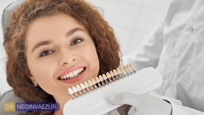 بهترین دکتر کامپوزیت دندان در تبریز - ونیر کامپوزیت در ولیعصر تبریز