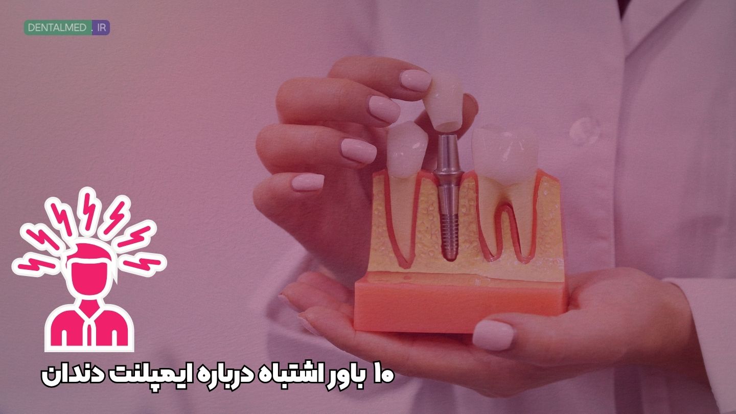 باورهای اشتباه درباره ایمپلنت دندان مثل ماندگاری و عمر ایمپلنت ، درد ایمپلنت و ترس از ایمپلنت
