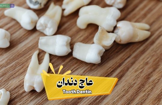عاج دندان چیست؟ انواع عاج، ساختار و نقش آن در درمان های دندناپزشکی dentin
