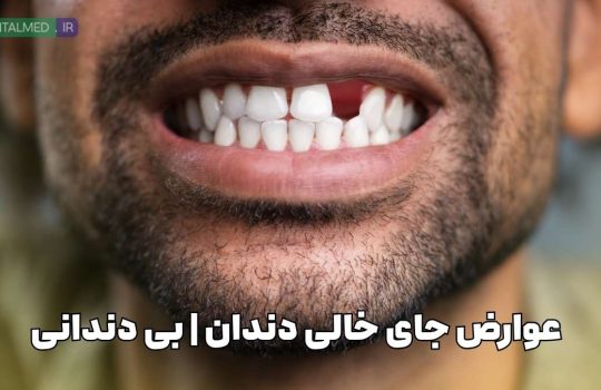 عوارض جای خالی دندان خطرات از دست دادن دندان درمان جای خالی دندان تحلیل استخوان فک بعد از کشیدن دندان بهترین روش جایگزینی دندان از دست رفته ایمپلنت برای دندان از دست رفته عواقب بی‌دندانی
